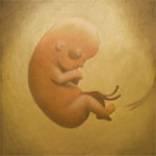 Leech (EST) : Disconnected